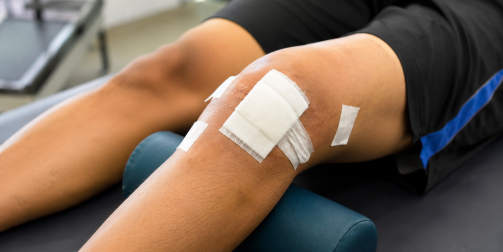 ACL injury treatment cebu